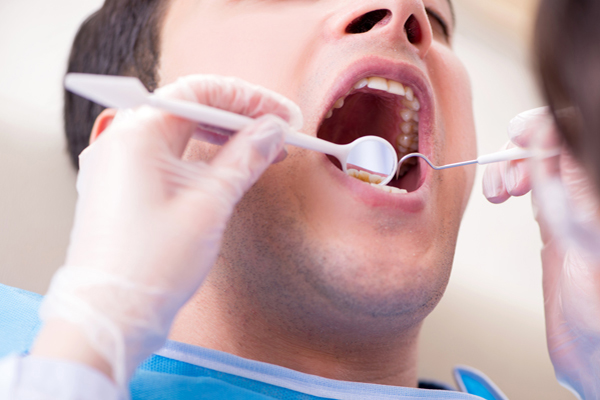 General Dentistry:   Myths About Dental Exams